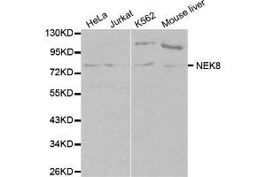 Image no. 3 for anti-NIMA-Related Kinase 8 (NEK8) antibody (ABIN3021226)