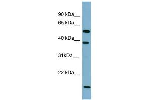 Image no. 1 for anti-Solute Carrier Family 10 (Sodium/bile Acid Cotransporter Family), Member 1 (SLC10A1) (Middle Region) antibody (ABIN2777141)