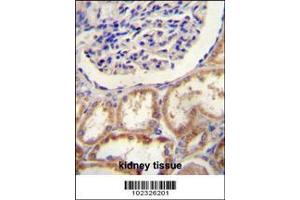 Image no. 2 for anti-HtrA Serine Peptidase 1 (HTRA1) (AA 116-147), (N-Term) antibody (ABIN388127)