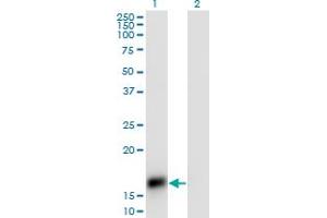 anti-CART Prepropeptide (CARTPT) (AA 1-116) antibody