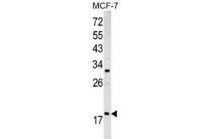 Image no. 1 for anti-ADP-Ribosylation Factor 3 (ARF3) (Middle Region) antibody (ABIN452754)