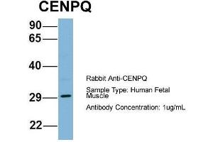 Host: Rabbit  Target Name: CENPQ  Sample Tissue: Human Fetal Muscle  Antibody Dilution: 1.