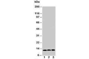 Image no. 1 for anti-Macrophage Migration Inhibitory Factor (Glycosylation-Inhibiting Factor) (MIF) (C-Term) antibody (ABIN3031673)