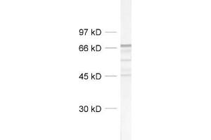 Image no. 1 for anti-Neurofilament, Light Polypeptide (NEFL) (AA 1-284) antibody (ABIN1742358)