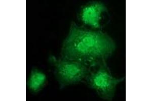 Image no. 4 for anti-Glutathione S-Transferase theta 2 (GSTT2) antibody (ABIN1498554)
