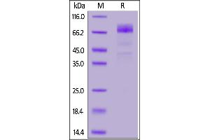 Image no. 2 for CD36 (CD36) (AA 30-439) (Active) protein (His tag,AVI tag,Biotin) (ABIN6972985)