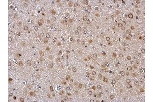 IHC-P Image Galanin Receptor 2 antibody detects Galanin Receptor 2 protein at membrane and cytosol on rat fore brain by immunohistochemical analysis.