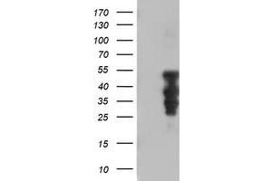 Image no. 1 for anti-Homeobox C11 (HOXC11) (AA 1-304) antibody (ABIN2723000)
