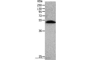 Image no. 1 for anti-BPI Fold Containing Family B, Member 2 (BPIFB2) antibody (ABIN2426145)