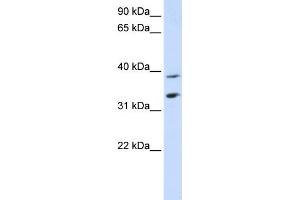 Image no. 1 for anti-Solute Carrier Family 25, Member 34 (SLC25A34) (Middle Region) antibody (ABIN2781753)