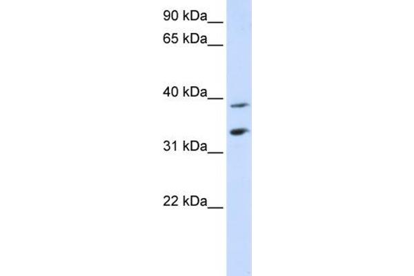 anti-Solute Carrier Family 25, Member 34 (SLC25A34) (Middle Region) antibody