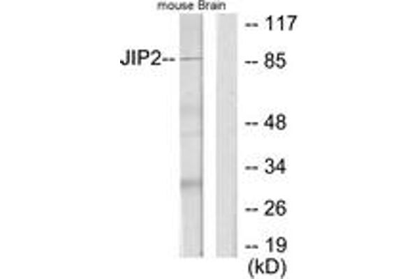 IB2 antibody  (AA 581-630)