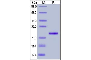 Recombinant Protein G, His Tag on  under reducing (R) condition.