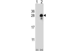 Image no. 2 for anti-delta-Like 2 Homolog (DLK2) antibody (ABIN3004005)