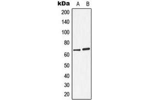Image no. 3 for anti-Arylsulfatase D (ARSD) (Center) antibody (ABIN2705517)