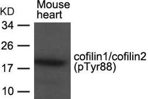 Cofilin1/2 (CFL1/2) (pTyr88) antibody