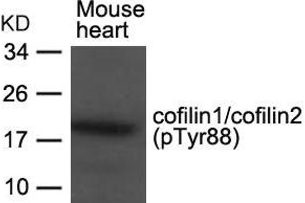 Cofilin1/2 (CFL1/2) (pTyr88) antibody