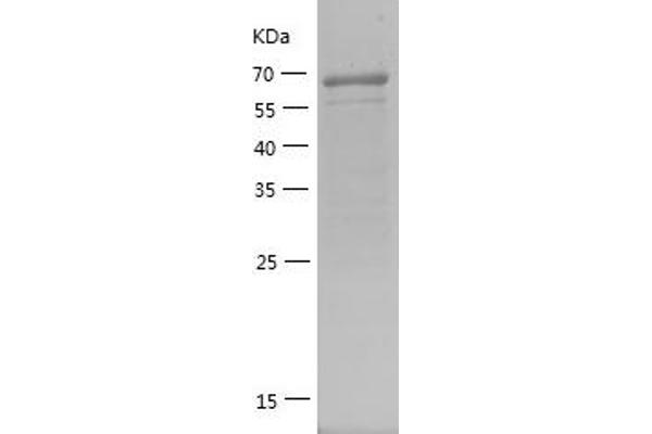 HDAC1 Protein (AA 183-482) (GST tag)