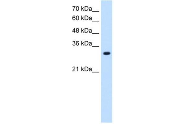 anti-Solute Carrier Family 7 (Amino Acid Transporter, L-Type), Member 8 (SLC7A8) (Middle Region) antibody