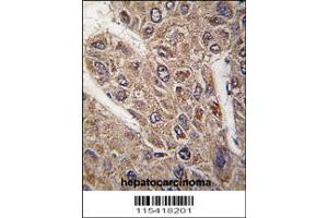 Image no. 2 for anti-Bicaudal D Homolog 2 (BICD2) antibody (ABIN2157899)
