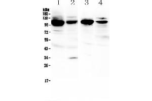 Image no. 1 for anti-Vascular Cell Adhesion Molecule 1 (VCAM1) (AA 25-270) antibody (ABIN5519072)