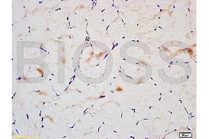 Image no. 1 for anti-Insulin Receptor Substrate 2 (IRS2) (AA 501-600) antibody (ABIN725840)