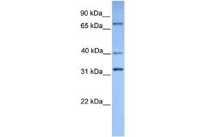 Image no. 3 for anti-SUZ12 Polycomb Repressive Complex 2 Subunit (SUZ12) (Middle Region) antibody (ABIN2779689)