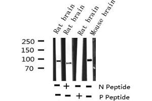 Image no. 1 for anti-Dynamin 1 (DNM1) (pSer774) antibody (ABIN6256419)