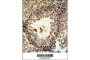 Image no. 2 for anti-PHD Finger Protein 13 (PHF13) (C-Term) antibody (ABIN2492564)