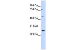 Image no. 1 for anti-Spermatogenesis Associated 22 (SPATA22) antibody (ABIN2460089)