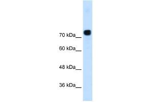 Image no. 1 for anti-Actinin, alpha 4 (ACTN4) (N-Term) antibody (ABIN2775288)