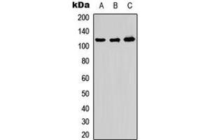 Image no. 1 for anti-ADAM Metallopeptidase with Thrombospondin Type 1 Motif, 10 (ADAMTS10) (Center) antibody (ABIN2705403)