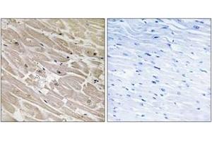 anti-Mitochondrial Ribosomal Protein L46 (MRPL46) (AA 111-160) antibody