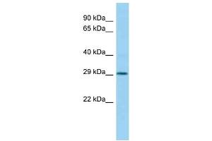 Image no. 1 for anti-Homeobox C11 (HOXC11) (N-Term) antibody (ABIN2780909)