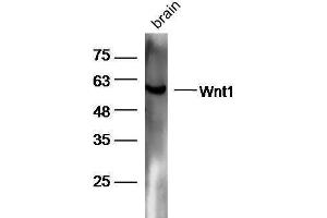 Image no. 4 for anti-Wingless-Type MMTV Integration Site Family, Member 1 (WNT1) (AA 251-350) antibody (ABIN733748)