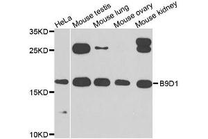 Image no. 4 for anti-B9 Protein Domain 1 (B9D1) antibody (ABIN6137409)