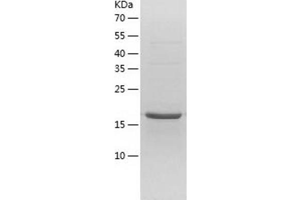NOP16 Protein (AA 1-178) (His tag)