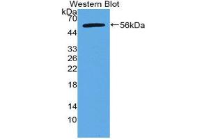 Image no. 1 for anti-Apoptosis Antagonizing Transcription Factor (AATF) (AA 273-477) antibody (ABIN2118436)