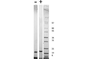 SDS-PAGE of Rat Stem Cell Factor Recombinant Protein SDS-PAGE of Rat Stem Cell Factor Recombinant Protein.