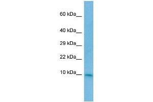 CC2D2A antibody  (N-Term)