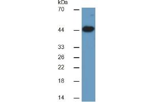 Image no. 4 for Creatine Kinase, Muscle (CKM) ELISA Kit (ABIN6574139)