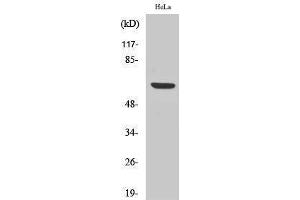 Image no. 1 for anti-Hyaluronan Binding Protein 2 (HABP2) (Internal Region) antibody (ABIN3181839)