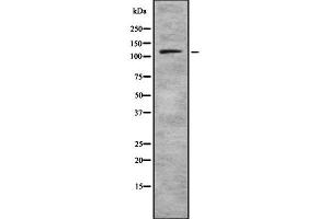 Image no. 1 for anti-Phospholipase D1 (PLD1) (Internal Region) antibody (ABIN6264295)