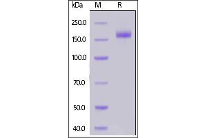 Image no. 3 for SARS-CoV-2 Spike (B.1.1.7 - alpha) (Active) protein (His tag) (ABIN7013275)