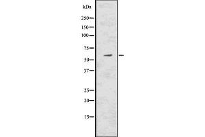 Image no. 2 for anti-Catalase (CAT) antibody (ABIN6260491)