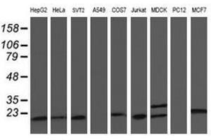 Image no. 17 for anti-Chromosome 1 Open Reading Frame 50 (C1ORF50) antibody (ABIN1497033)