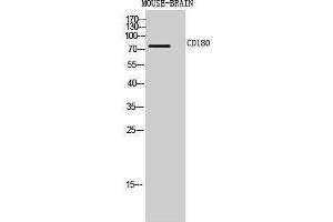 Image no. 1 for anti-CD180 Molecule (CD180) (Internal Region) antibody (ABIN3181467)