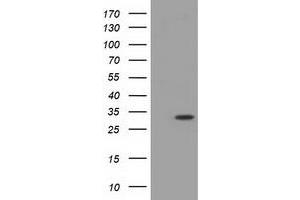 Image no. 1 for anti-Myo-Inositol Oxygenase (MIOX) antibody (ABIN2723470)