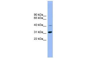 Image no. 1 for anti-IQ Motif Containing D (IQCD) (Middle Region) antibody (ABIN633007)