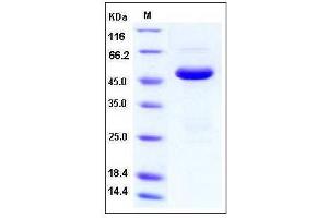 Image no. 1 for SET Domain Containing (Lysine Methyltransferase) 7 (SETD7) (AA 2-366) protein (His tag) (ABIN2004086)